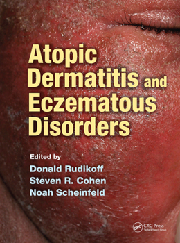 Paperback Atopic Dermatitis and Eczematous Disorders Book