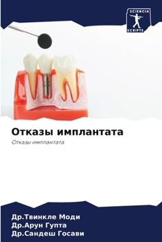 Paperback Отказы имплантата [Russian] Book