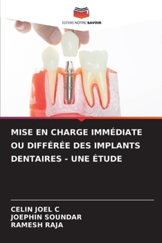 Paperback Mise En Charge Immédiate Ou Différée Des Implants Dentaires - Une Étude [French] Book