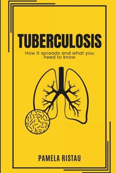 Paperback Tuberculosis: How it Spreads and What you need to know Book