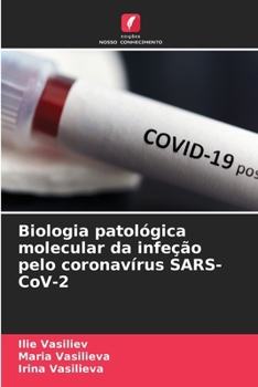 Biologia patológica molecular da infeção pelo coronavírus SARS-CoV-2 (Portuguese Edition)