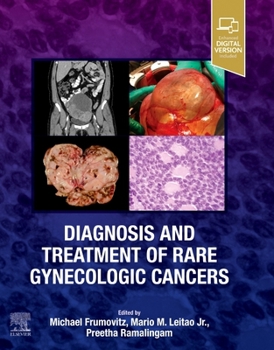 Hardcover Diagnosis and Treatment of Rare Gynecologic Cancers Book