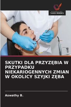 Skutki Dla PrzyzEbia W Przypadku Niekariogennych Zmian W Okolicy Szyjki ZEba (Polish Edition)