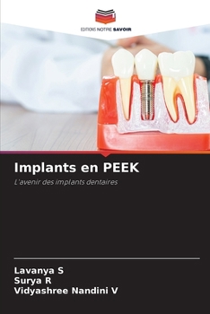 Paperback Implants en PEEK [French] Book