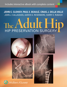 Hardcover The Adult Hip: Hip Preservation Surgery Book