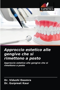 Paperback Approccio estetico alle gengive che si rimettono a posto [Italian] Book