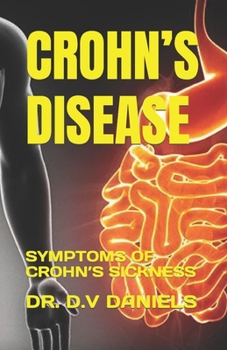 Paperback Crohn's Disease: Symptoms of Crohn's Sickness Book