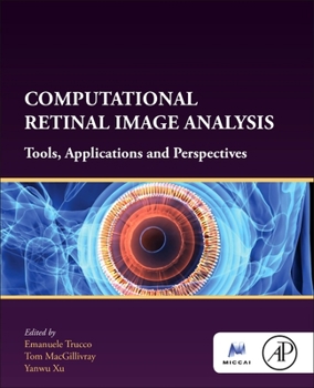 Paperback Computational Retinal Image Analysis: Tools, Applications and Perspectives Book