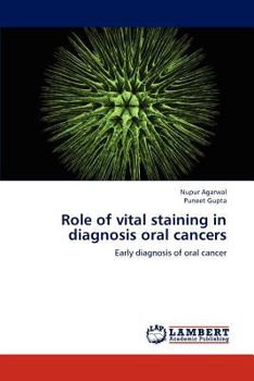 Paperback Role of vital staining in diagnosis oral cancers Book