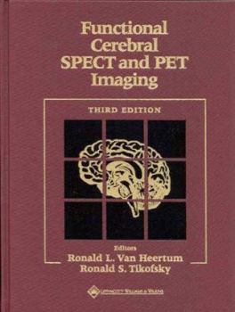 Functional Cerebral SPECT and PET Imaging