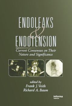 Hardcover Endoleaks and Endotension: Current Consensus on Their Nature and Significance Book