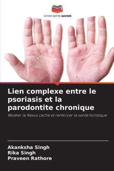 Paperback Lien complexe entre le psoriasis et la parodontite chronique [French] Book