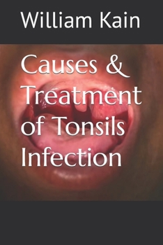 Paperback Causes & Treatment of Tonsils Infection Book
