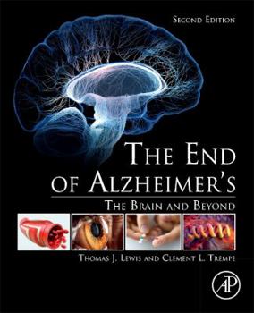 Paperback The End of Alzheimer's: The Brain and Beyond Book