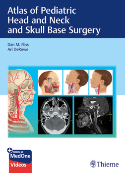 Hardcover Atlas of Pediatric Head and Neck and Skull Base Surgery Book