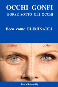 Paperback OCCHI GONFI BORSE SOTTO GLI OCCHI? Ecco come eliminarli [Italian] Book