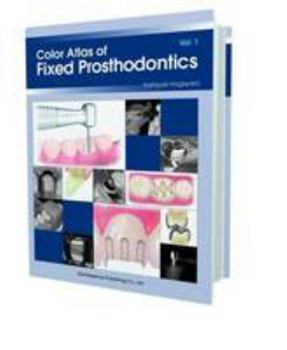 Paperback Color Atlas of Fixed Prosthodontics Book