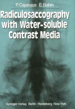 Paperback Radiculosaccography with Water-Soluble Contrast Media Book