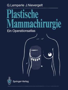 Paperback Plastische Mammachirurgie: Ein Operationsatlas [German] Book