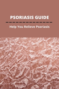 Paperback Psoriasis Guide: Help You Relieve Psoriasis: Psoriasis Treatment Diet Book