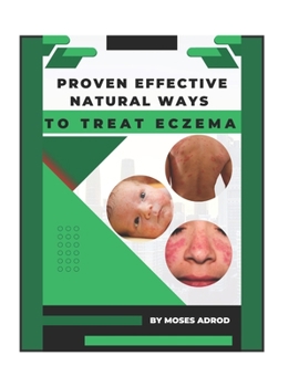 Paperback Proven Effective Natural Ways to Treat Eczema Book