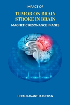 Paperback Impact of Tumor on Brain Stroke in Brain Magnetic Resonance Images Book