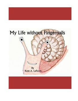Paperback My Life Without Fingernails Book