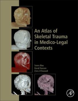 Hardcover An Atlas of Skeletal Trauma in Medico-Legal Contexts Book