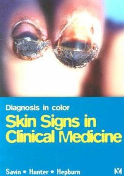 Paperback Diagnosis in Color: Skin Signs in Clinical Medicine Book