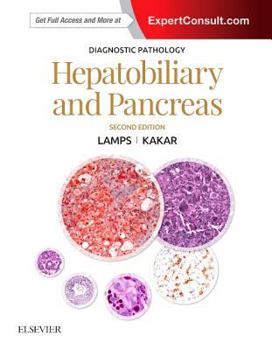 Hardcover Diagnostic Pathology: Hepatobiliary and Pancreas Book