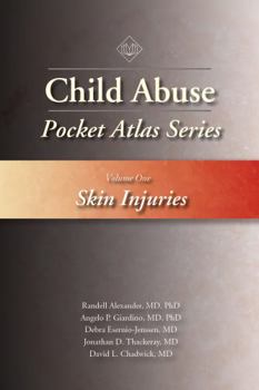 Paperback Child Abuse Pocket Atlas Series, Volume 1: Skin Injuries Book