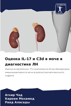 Paperback Оценка IL-17 и C3d в моче в диагно&# [Russian] Book