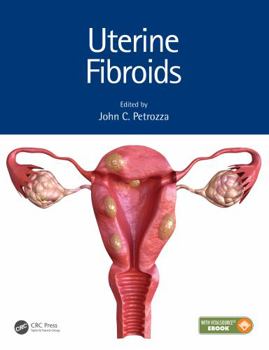 Hardcover Uterine Fibroids Book