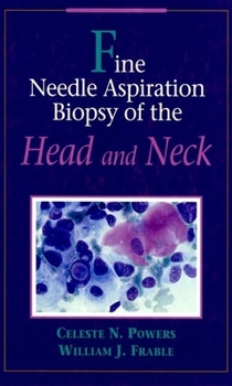 Hardcover Fine Needle Aspiration Biopsy of the Head and Neck Book