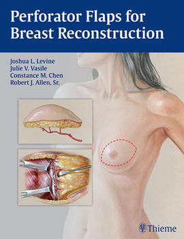 Hardcover Perforator Flaps for Breast Reconstruction Book