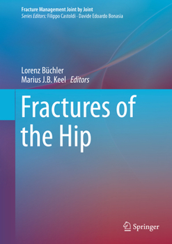 Fractures of the Hip (Fracture Management Joint by Joint)