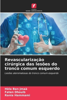 Paperback Revascularização cirúrgica das lesões do tronco comum esquerdo [Portuguese] Book