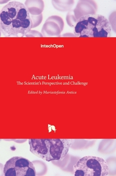 Hardcover Acute Leukemia: The Scientist's Perspective and Challenge Book