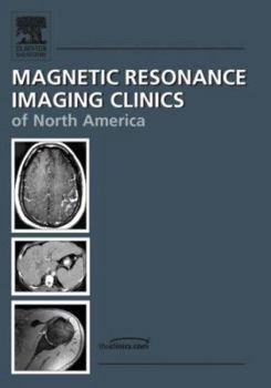 Hardcover The Knee, an Issue of Magnetic Resonance Imaging Clinics: Volume 15-1 Book