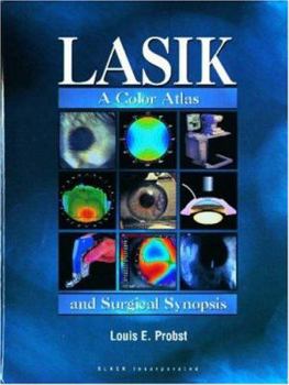 Hardcover LASIK: A Color Atlas and Surgical Synopsis Book