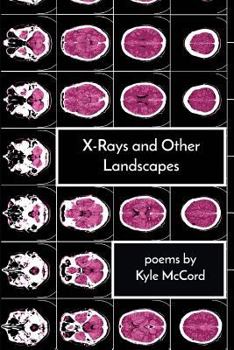 Paperback X-Rays and Other Landscapes Book