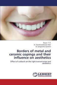 Paperback Borders of Metal and Ceramic Copings and Their Influence on Aesthetics Book