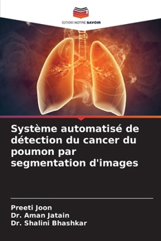 Paperback Système automatisé de détection du cancer du poumon par segmentation d'images [French] Book
