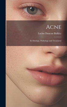 Hardcover Acne: Its Etiology, Pathology and Treatment Book