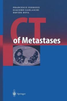 Paperback CT of Metastases Book