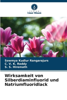 Paperback Wirksamkeit von Silberdiaminfluorid und Natriumfluoridlack [German] Book