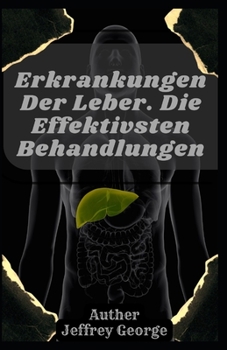 Paperback Erkrankungen Der Leber: Die Effektivsten Behandlungen [German] Book