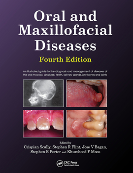 Paperback Oral and Maxillofacial Diseases, Fourth Edition Book