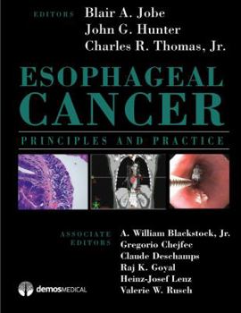 Hardcover Esophageal Cancer: Principles and Practice Book