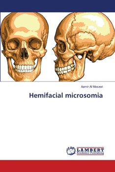 Paperback Hemifacial microsomia Book